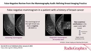 Image result for Mammogram Interpretation