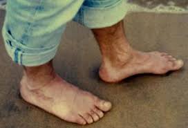 Resultado de imagen de pedicura hombre