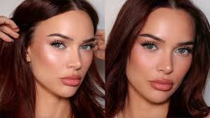 CHIN LIPO: The Entire Experience *long term results*