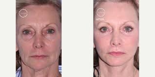 T. Gerald O`Daniel, MD, Board Certified Plastic Surgeon