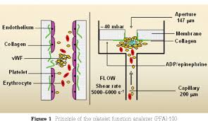 Image result for Platelet Function Closure Time