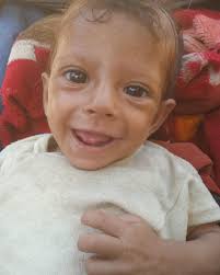 Beautiful Sandy is 7 months old yet weighs only 4.7kg due to being severely  malnourished 💔 Her family live in G@za where the situation is  catastrophic. Please contribute to the 🔗 in