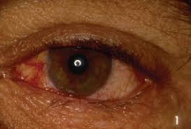 Image result for Blepharis bainesii