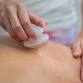 Lift & Lengthen: Techniques Combining Cupping and Stretching