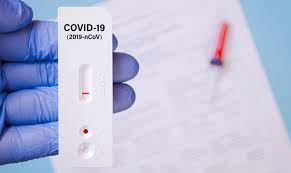 Sauf que dans ce cas, pas besoin d'aller jusqu'au. Las Farmacias Espanolas Cuentan Con Una Guia Para La Dispensacion De Los Autotest De Anticuerpos De La Covid 19 Web De Portalfarma