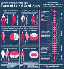 Image result for Spinal Shock
