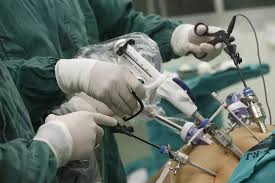 Laparoscopy and Robotic Surgery ...