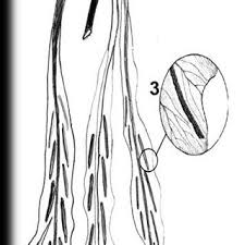 Image result for Blotiella bouxiniana