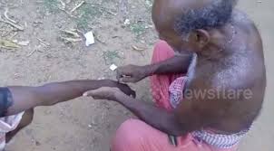 A venomous (poisonous) snake bite is a bite or a puncture wound made by a snake that is capable of injecting, secreting, or spitting venom into the penetrated skin wound. Shaman Cuts Up Snake Bite Victim S Arm With Razor Blade In Folk Treatment World News Mirror Online