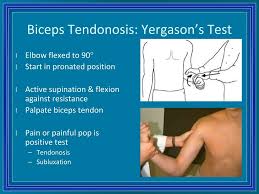 Image result for Yergason Test