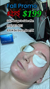 ✨ Microneedling with Exosomes