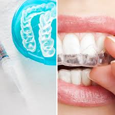 Wenn sie ihre zähne bleichen lassen, können kleinere nebenwirkungen auftreten. Asthetik Bleaching Veneers Praxisfamilie Kohrer Kollegen