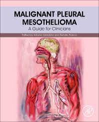 Mesotheliomas can start in 4 main parts of the body. Malignant Pleural Mesothelioma 1st Edition