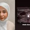 Hasil usg bayi perempuan ini reaksi raffi ahmad. Https Encrypted Tbn0 Gstatic Com Images Q Tbn And9gcrrbn9bxlghrrcssjlh143gops69uw775xacjcvbw6nn9t6 3ve Usqp Cau
