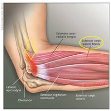 (from last, dictionary of epidemiology, 2d ed). Mill S Test Physiopedia