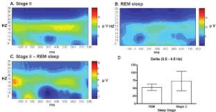 comparisons of frequency bands between sleep stages a