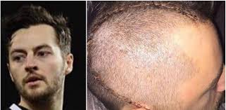 Ryan Mason, jugador del Hull City, obligado a dejar el fútbol