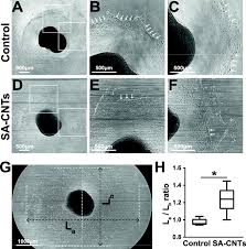 51 5074° n, 0 1278° w updated. A Carbon Nanotubes Based In Situ Multifunctional Power Assist System For Restoring Failed Heart Function Springerlink