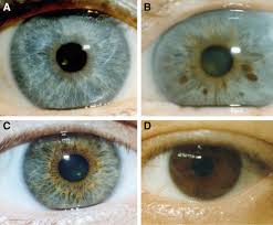 rayid iridology 4