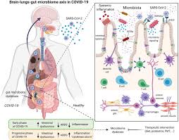 Maybe you would like to learn more about one of these? Gastrointestinal Symptoms Associated With Covid 19 Impact On The Gut Microbiome Translational Research