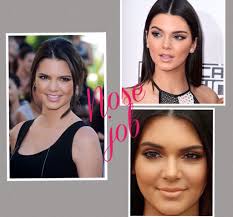 Kendall Jenner Nose Job Kendall Jenner Nose Job Nose Job Makeup Looks