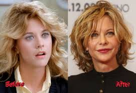 The star of romantic comedies of the 90's meg ryan has repeatedly been included in the list of the sexiest actresses in hollywood. Meg Ryan Before And After Cosmetic Surgery Plastic Surgery Mistakes