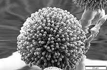 The most effective treatment is a newer antifungal drug, voriconazole (vfend). Aspergillus Niger Wikipedia