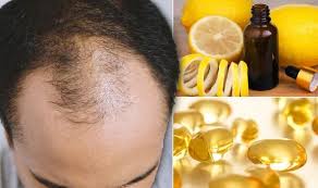 This article contains some homemade hair growth treatments that won't damage your hair or break your budget! Hair Loss Treatments What Are The Best Natural Remedies To Boost Hair Growth Express Co Uk