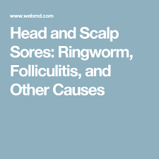 Why Do I Have Sores On My Head Soreness Sores On Scalp Itchy Skin