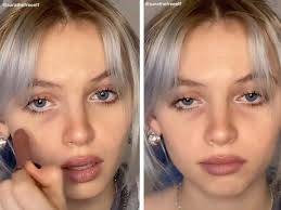 Medical treatment options for dark circles. Tiktok Users Are Drawing Dark Circles And Under Eye Bags On Their Faces