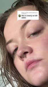 Replying to @Alex Jamie Cameron This song came out in March 2024, I got my  jaw surgery in september 2023! hope this helps.🩷 also…I look like I should  be in a puffs plus commercial…🤣 @Hozier hey you ...