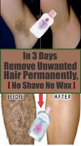 It is done by applying a thin layer of artificial wax(slightly hot wax) and. Unwanted Hair Removal Tips Healthy Medicine Tips Unwanted Hair Permanently Unwanted Hair Removal Unwanted Hair