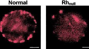 Cercetătorii au descoperit că, pentru fiecare grupă de sânge există anumite alimente benefice. Cel Mai Rar Tip De Sange I Se Spune Sangele De Aur Si Doar 43 De Persoane Din Intreaga Lumea Il Au Video Jurnal Md