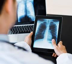 We are an accredited health provider so you can claim our fees from your private health insurance. Digital X Rays Vs Traditional X Rays Independent Imaging