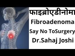 फ इब र एड न म Can Fibroadenoma Convert Into Breast Cancer In Hindi Youtube