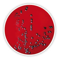The inhibigen in brilliance salmonella agar targets escherichia coli. Xld Agar 500 G Media For Salmonella Shigella Anhydrous Nutrient Media For Microbiology Microbiology Life Science Carl Roth International