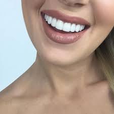 A Lot Of You Have Been Asking About My Teeth Recently And If I Ve Changed Them I Upgraded From Composite Ve Beautiful Teeth Beautiful Smile Teeth Pretty Teeth