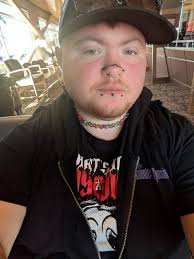 Managed to get stud in instead of ring but it's to short I don't wanna  leave it in long till tomorrow , 8mm is what it is what size do I need