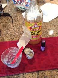Treating Bites And Stings Bites And Stings Remedies For Bee Stings Spider Bites