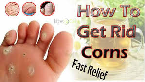 Make sure your diet contains vitamins a, d, e and f. How To Get Rid Of Corns In Proper Way