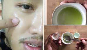 Jerawat boleh menjadi masalah yang mengganggu keperibadian seseorang dan menyebabkan mereka malu serta berkeyakinan rendah. Buat Gel Timun Untuk Kecutkan Jerawat Hasilnya Kulit Lelaki Ini Flawless Bak Putih Telur Maskulin