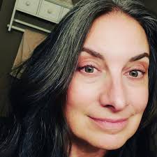 Rowe Casa products for contact dermatitis relief