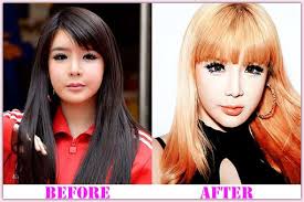 Park Bom Plastic Surgery What Went Wrong Plastic Surgery Fail Plastic Surgery Celebrity Plastic Surgery