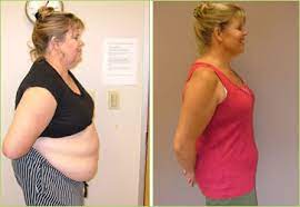 Adults live with obesity, and an astonishing majority (71.6%) are overweight, says the centers for disease control and prevention (cdc).with so many people living with excess weight, the problem is now well into epidemic territory. Lipotropic Injections Los Angeles Hollywood Weight Loss