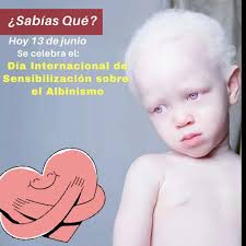 Sabias que? Hoy 13 de junio se celebra el Día Internacional de  Sensibilización sobre el Albinismo. Así que para mostrar tu apoyo y  solidaridad en esta causa utiliza una prenda blanca o