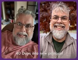 5 Years Sugar Free... NO CARBS. Most People Have No Idea How Their Bodies  are Supposed to Feel Until They REDUCE CARBS.. I Swear to God Our Bodies  Only Need Protein &