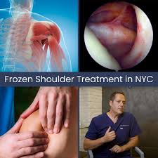Image result for Frozen Shoulder
