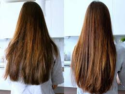 One of the easiest home remedies for folliculitis, neem has been used since ages to treat all kinds of skin disorders. Get The Scoop On White Vinegar For Hair Before You Re Too Late Lewigs
