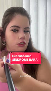 Síndrome de Moebius