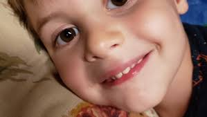 Fundraiser by Linda Green : Help Henry Smile Again